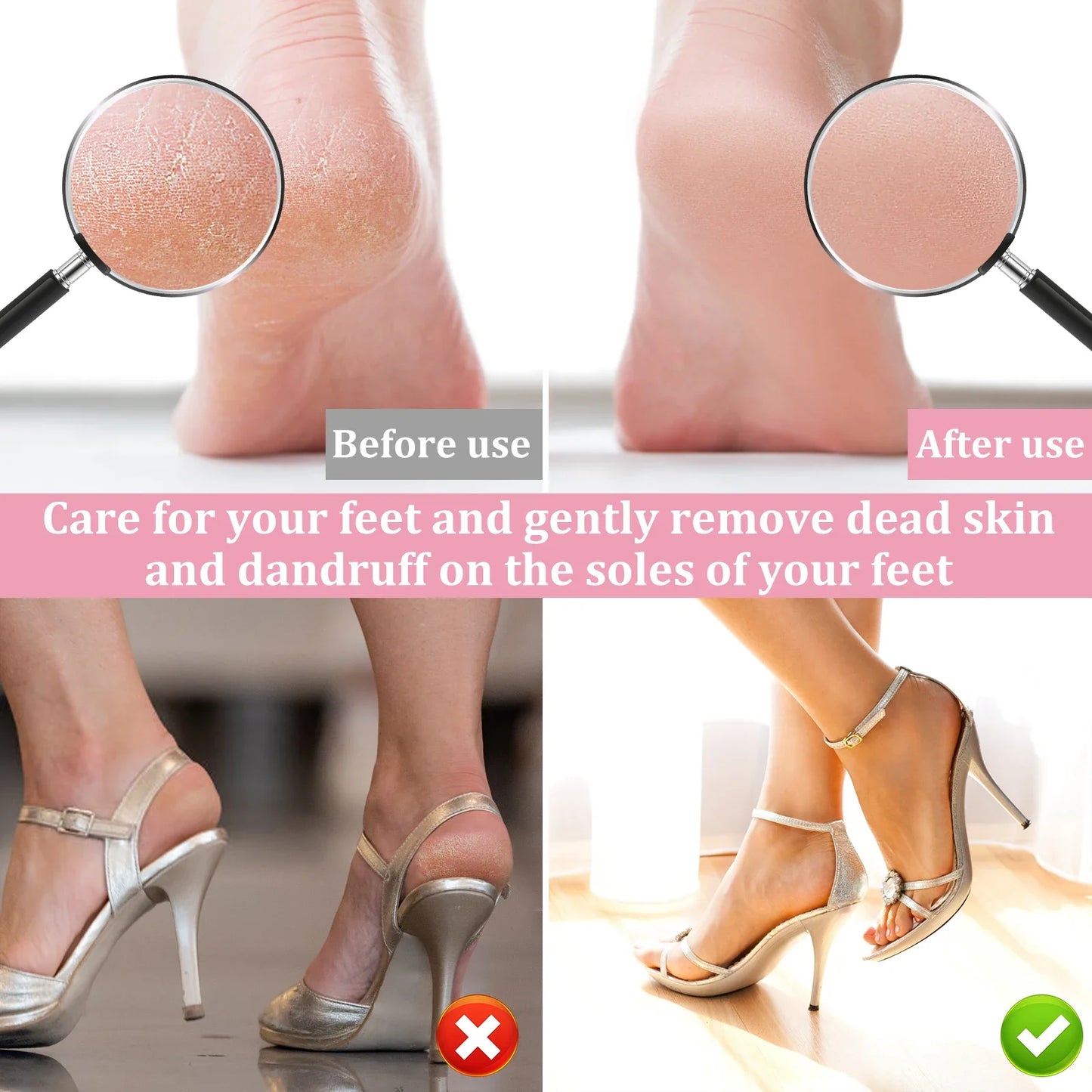 Judevil Electric Foot File